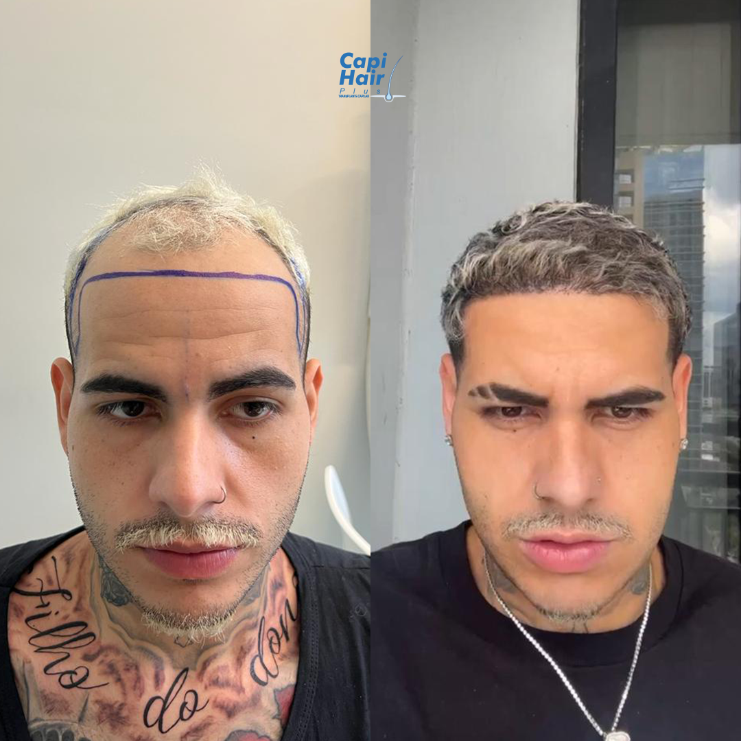 PS1